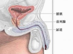 男人便秘竟会伤害前列腺？！